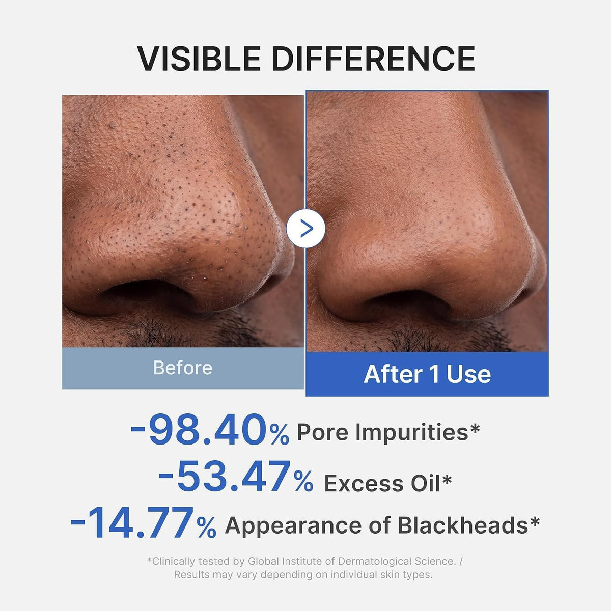 Medicube Zero Pore, maschera viso all’argilla